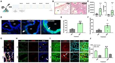 Matricellular Protein Periostin Promotes Pericyte Migration in Fibrotic Airways